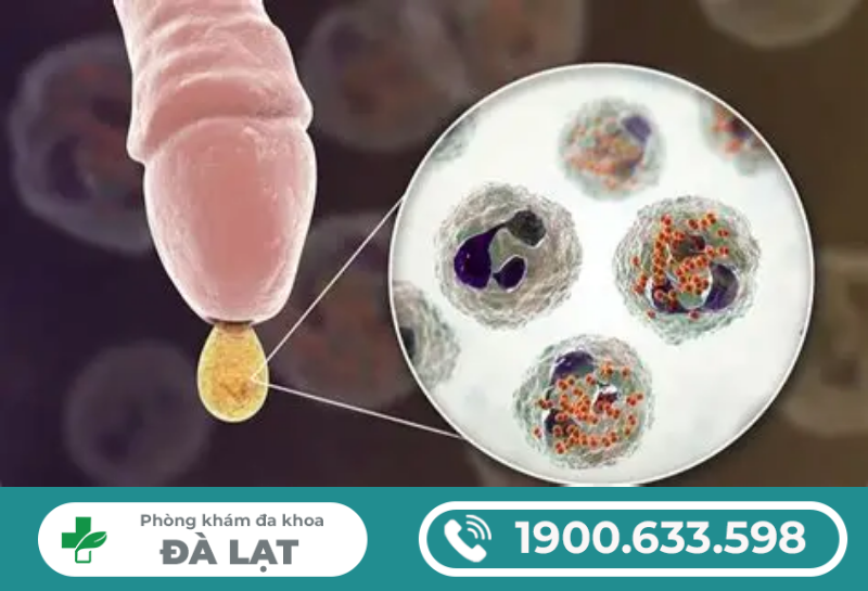 Hình ảnh minh họa